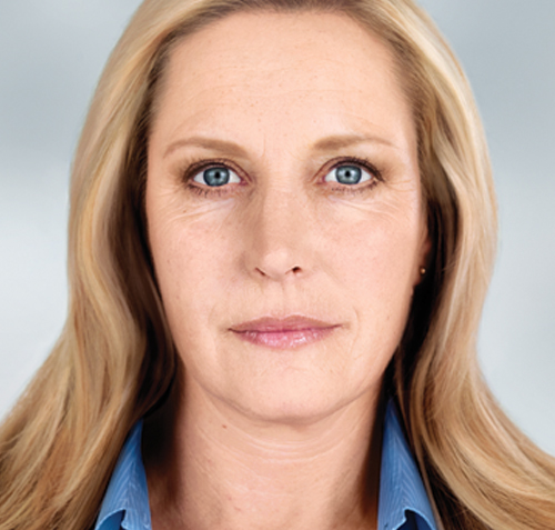 Now (after 24 months)